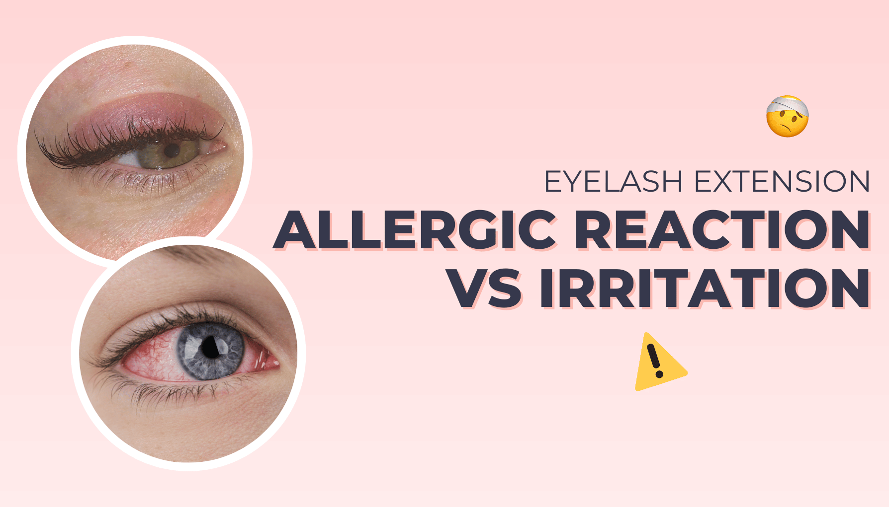 Eyelash Extensions Allergic Reaction vs. Irritation – Lash Jungle